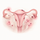 Endometriose